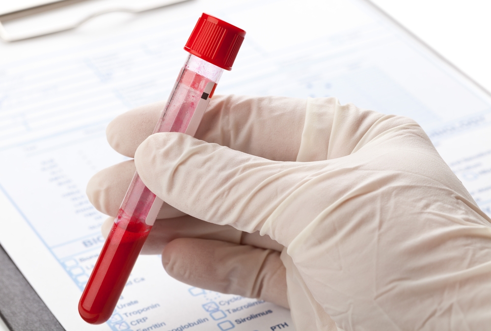 Exame-de-Sangue.1