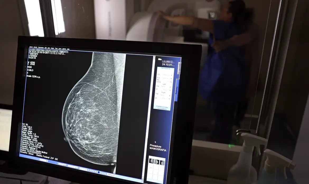CDH aprova projeto petista que garante exames de risco hereditário de câncer pelo SUS e planos privados